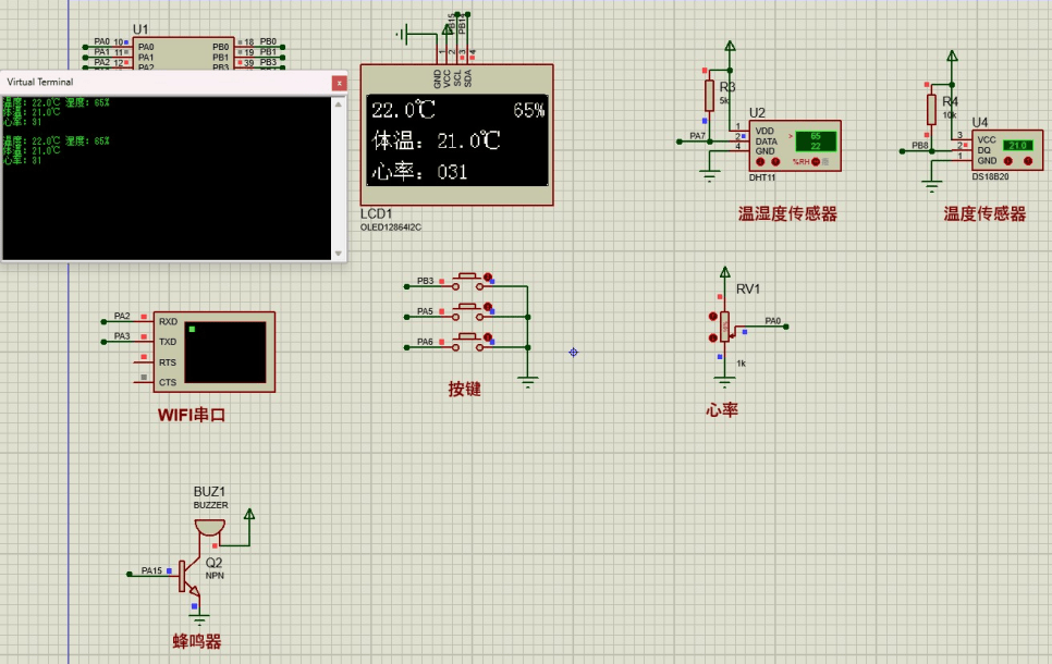 基于STM32的病房监测系统