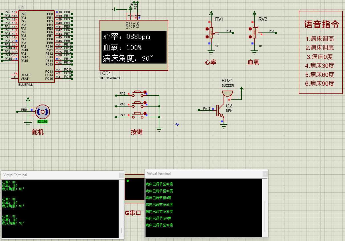 基于STM32的交互式护理床设计