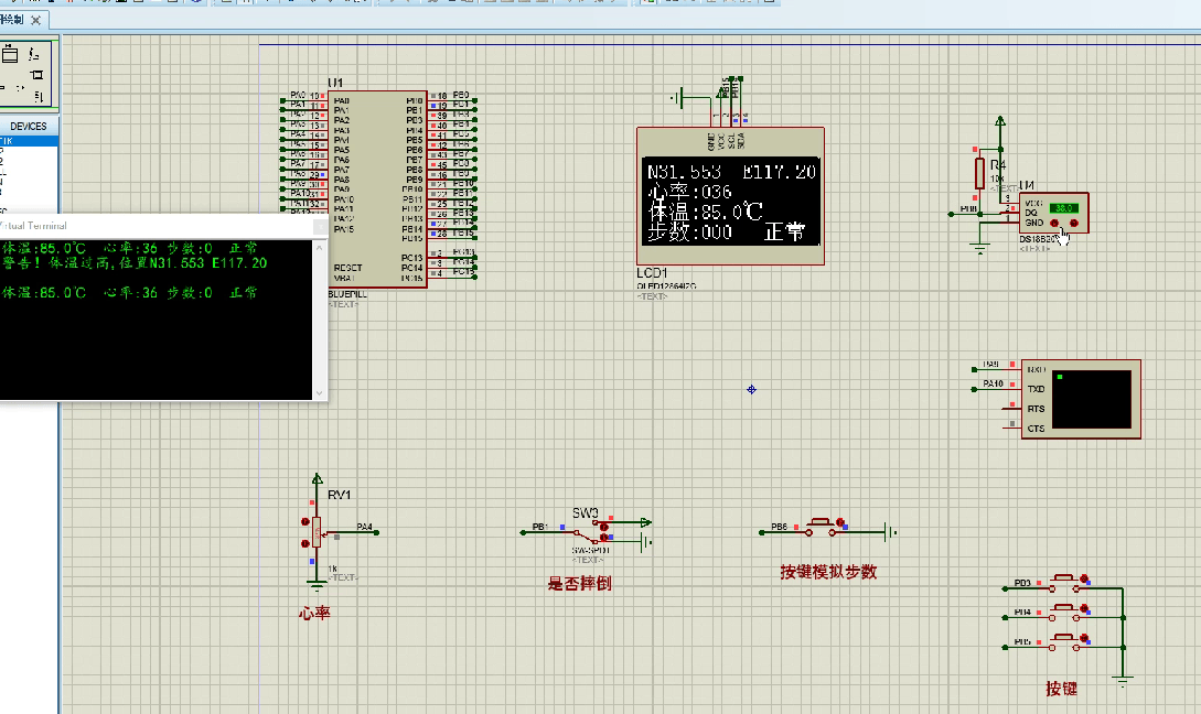 基于STM32的阿尔兹海默症的随行助手设计